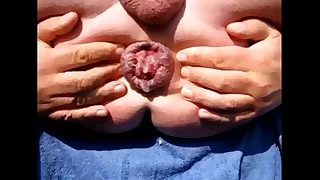 experimental asshole